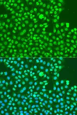 Immunocytochemistry/ Immunofluorescence: DNA-PKcs [p Ser2056] Antibody - Azide and BSA Free [NBP3-05444]